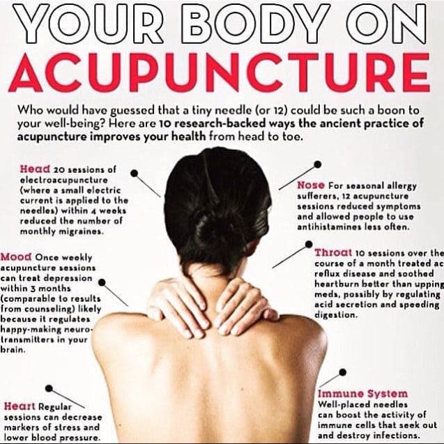 Acupuncture treatment for weight loss