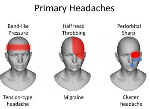 different type of headaches
