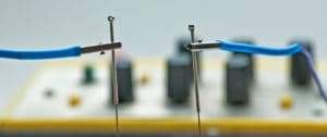 acupuncture needle